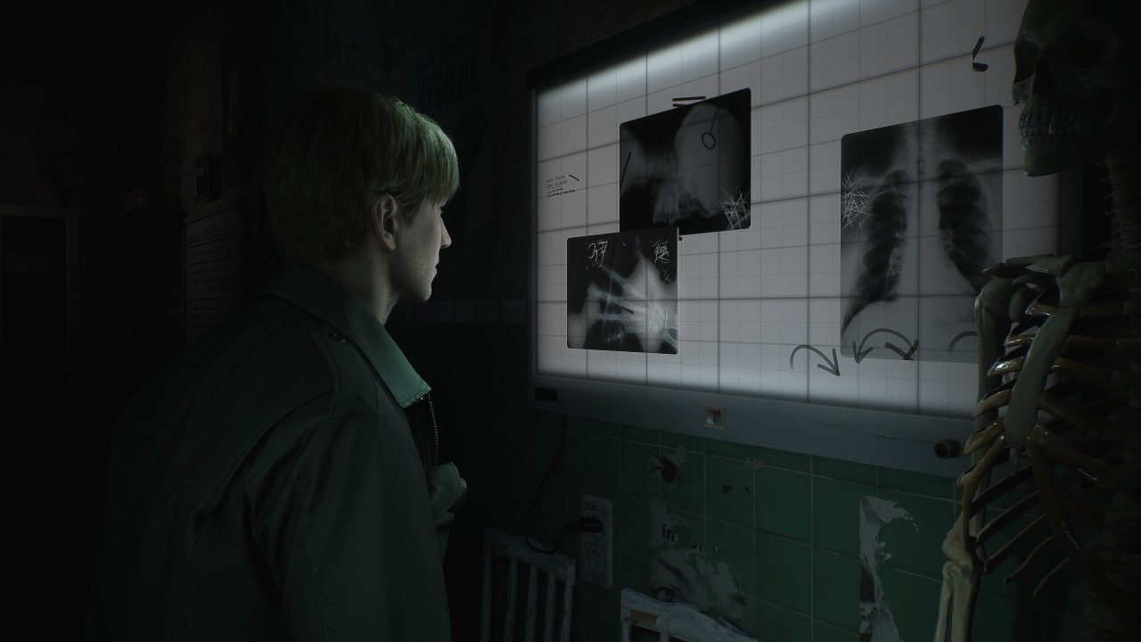 Picture of the game Silent Hill 2